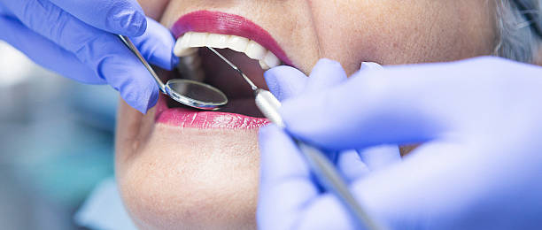Best Emergency Denture Repair in Redwood Falls, MN