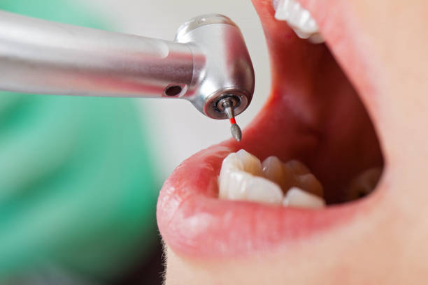 Best Dental Abscess Treatment in Redwood Falls, MN